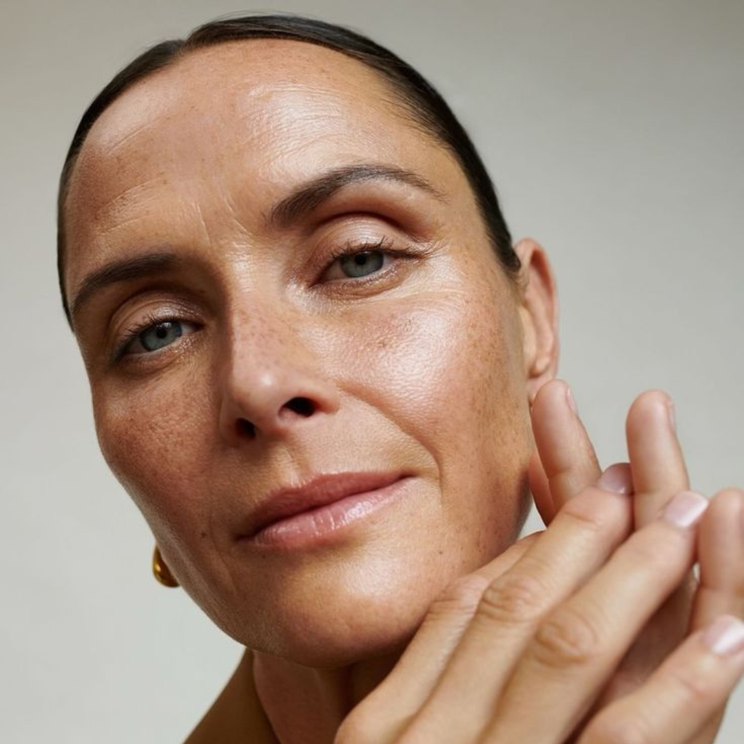 When Is the Best Time for IPL? Your Autumn & Winter Guide to Clearer Skin