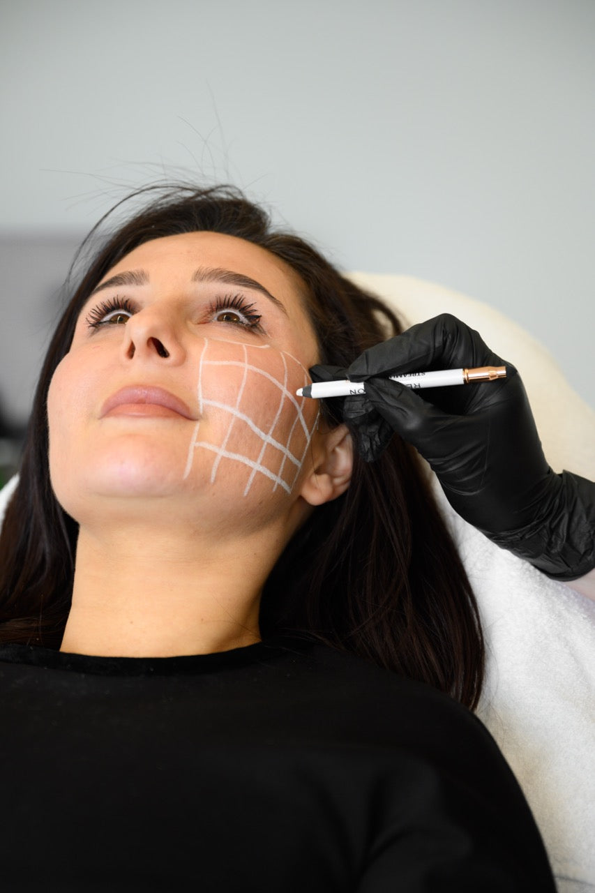 What Are Skin Boosters?