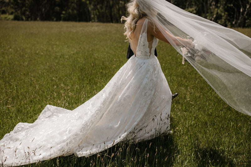 Your Skin Deserves a Wedding Plan Too